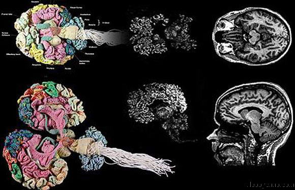 Сравните по фото вязаный и обычный мозг человека