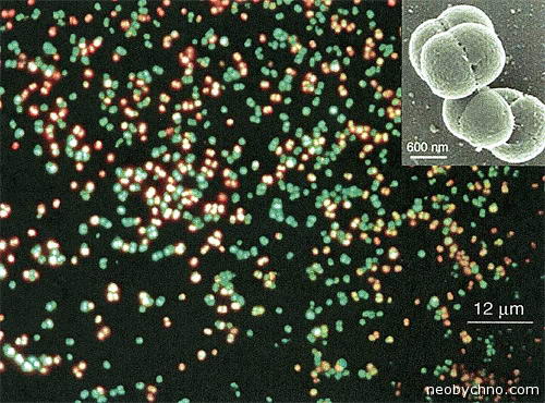 Галофильные бактерии Мертвого моря