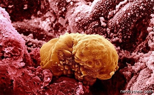 человеческий эмбрион 6 дней фото