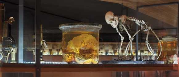 Бесценная коллекция человеческих мозгов и детских черепов на родине Джорджа Буша